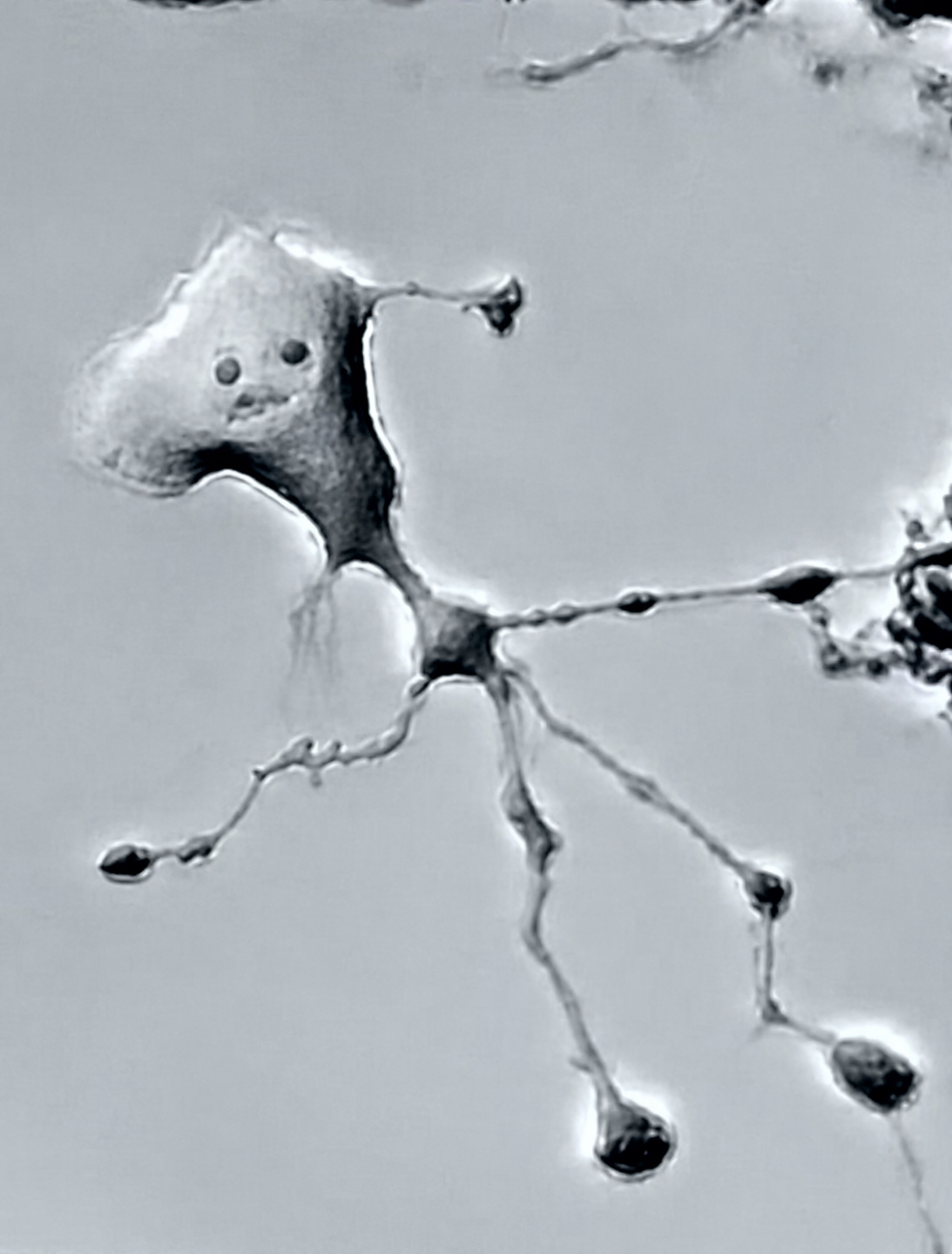 a neuron trying to connect